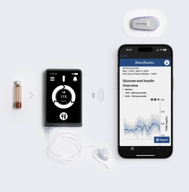 iLet Bionic Pancreas Automated Insulin Delivery System